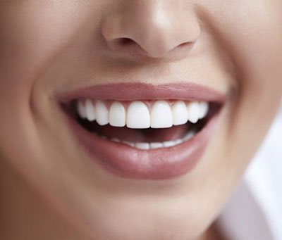 کامپوزیت ونیرة