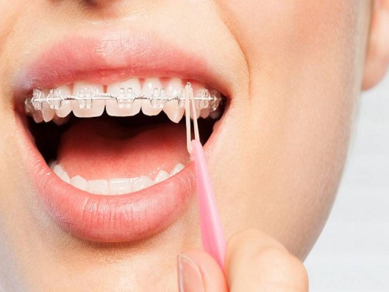 ارتودنسی در سعادت آباد